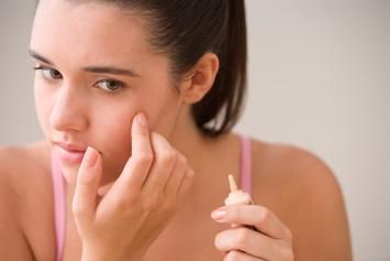 best-acne-concealers