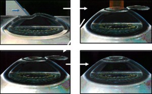 epi-lasik-1