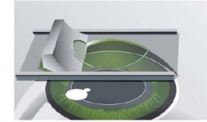 epi-lasik-4